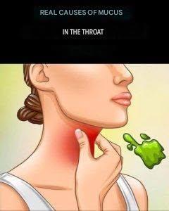 The real causes of persistent phlegm and mucus in the throat and how to eliminate them
