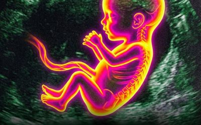 Autism: What if the mother’s intestinal balance during pregnancy played an unsuspected role?