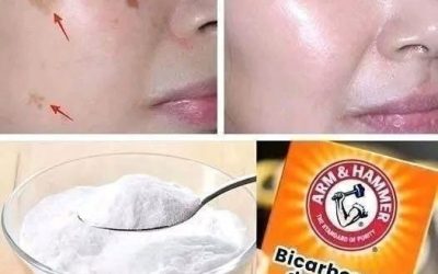 4 Ways to Erase Age Spots with Baking Soda for Younger, More Even Skin