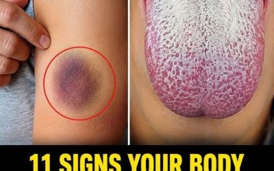 11 Signs Your Body Is Giving You Important Alerts…See more