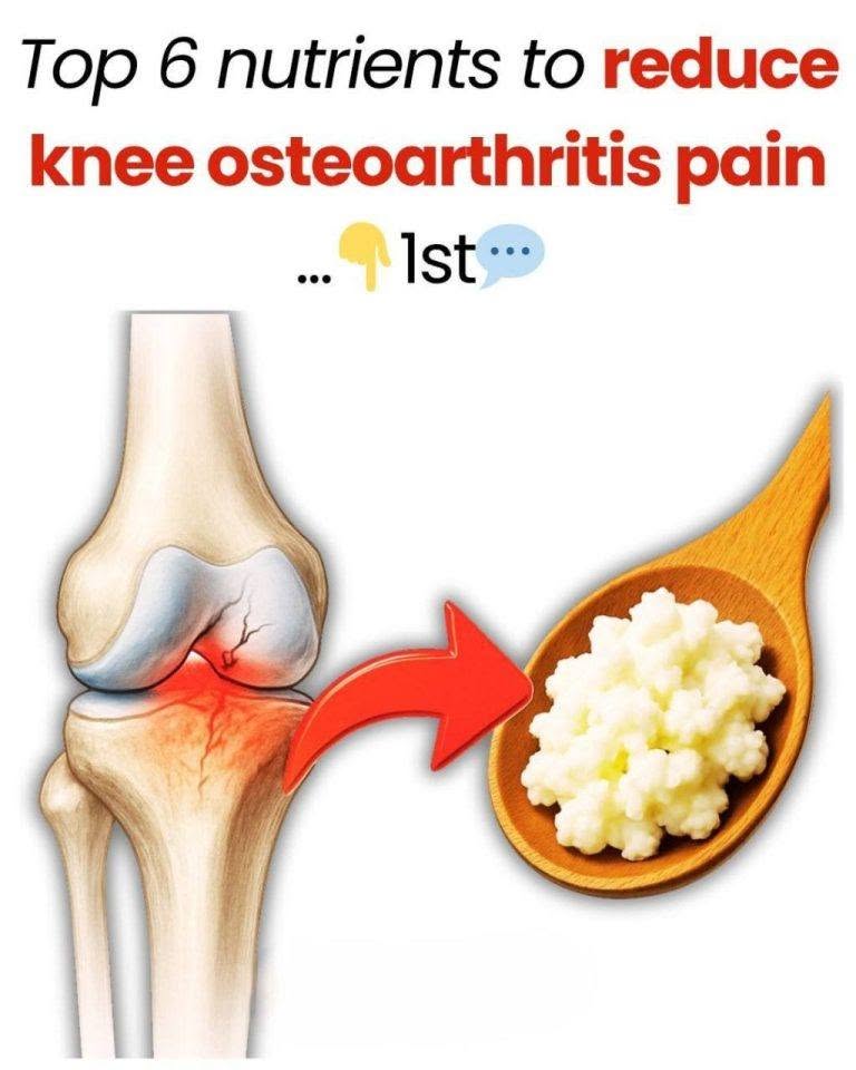 Top 6 Nutrients To Reduce Knee Osteoarthritis Pain Top 6 Nutrients To Reduce Knee Osteoarthritis Pain